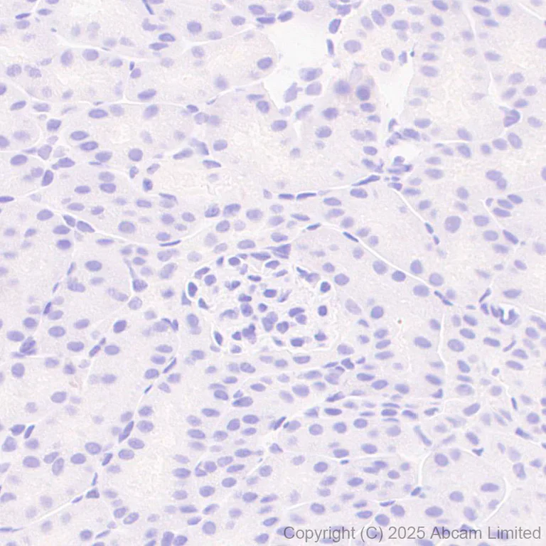 Immunohistochemistry (Formalin/PFA-fixed paraffin-embedded sections) - Anti-IL-1RA antibody [EPR29922-572] (AB324456)