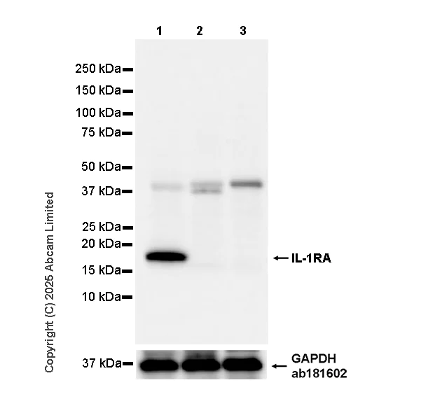 Western blot - Anti-IL-1RA antibody [EPR29922-572] (AB324456)