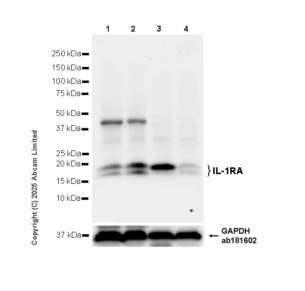 Western blot - Anti-IL-1RA antibody [EPR29922-572] (AB324456)
