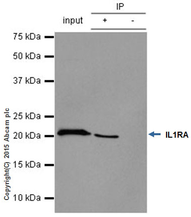 Immunoprecipitation - Anti-IL-1RA antibody [EPR6483] (AB124962)