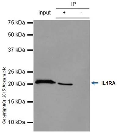 Immunoprecipitation - Anti-IL-1RA antibody [EPR6483] (AB124962)