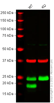 Western blot - Anti-IL-1RA antibody [EPR6483] (AB124962)