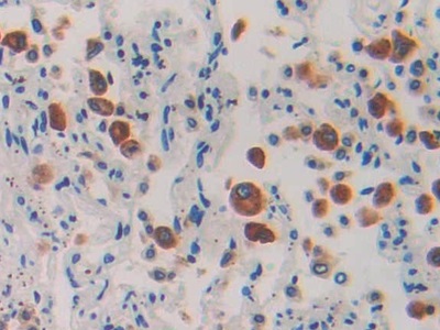 Immunohistochemistry (Formalin/PFA-fixed paraffin-embedded sections) - Anti-IL-1RAcP antibody (AB232950)