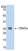 Western blot - Anti-IL-1RAcP antibody (AB232950)