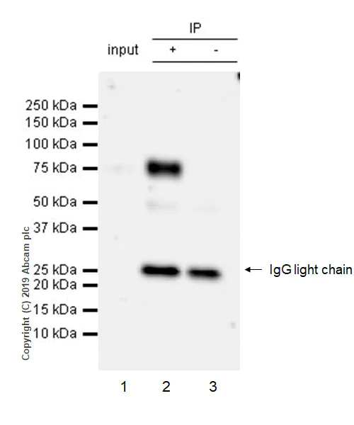 Immunoprecipitation - Anti-IL-1RAcP antibody [EPR22678-67] - BSA and Azide free (AB256764)