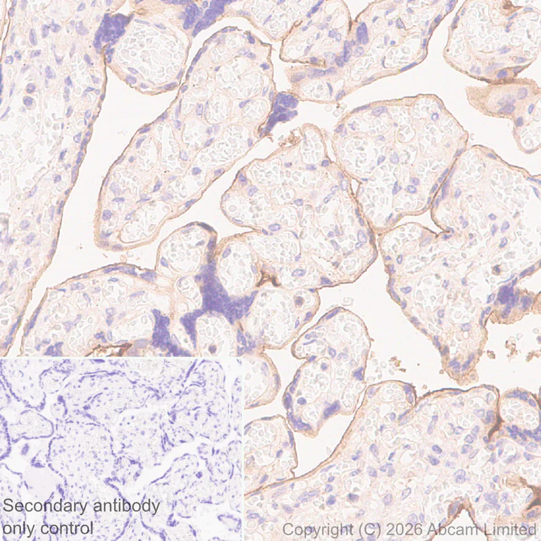 Immunohistochemistry (Formalin/PFA-fixed paraffin-embedded sections) - Anti-IL-1RAcP antibody [EPR31194-591] (AB326565)