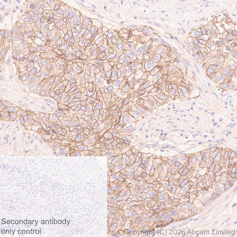 Immunohistochemistry (Formalin/PFA-fixed paraffin-embedded sections) - Anti-IL-1RAcP antibody [EPR31194-591] (AB326565)