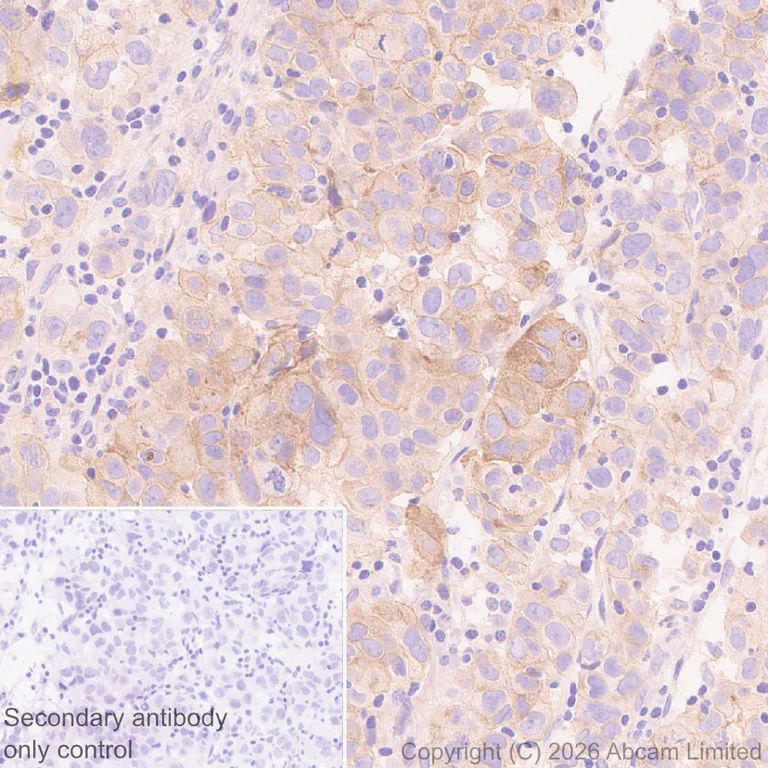 Immunohistochemistry (Formalin/PFA-fixed paraffin-embedded sections) - Anti-IL-1RAcP antibody [EPR31194-591] (AB326565)