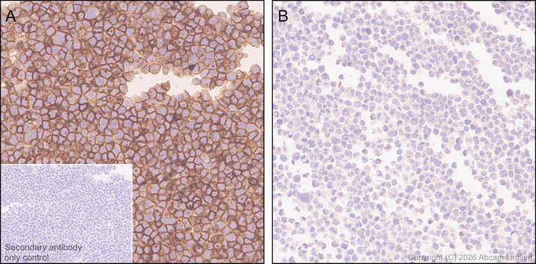 Immunohistochemistry (Formalin/PFA-fixed paraffin-embedded sections) - Anti-IL-1RAcP antibody [EPR31194-591] (AB326565)