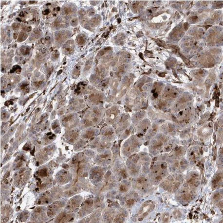 Immunohistochemistry (Formalin/PFA-fixed paraffin-embedded sections) - Anti-IL-1RAPL2 antibody (AB204081)