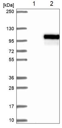 Western blot - Anti-IL-1RAPL2 antibody (AB204081), expandable thumbnail
