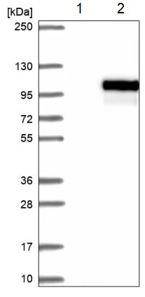 Western blot - Anti-IL-1RAPL2 antibody (AB204081)