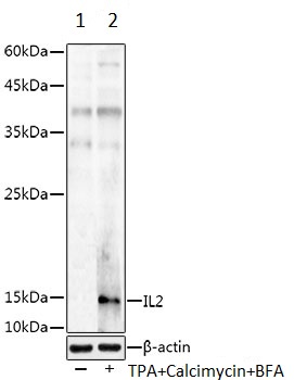 Western blot - Anti-IL-2 antibody (AB180780)