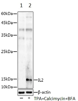 Western blot - Anti-IL-2 antibody (AB180780)