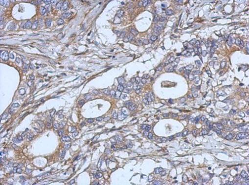 Immunohistochemistry (Formalin/PFA-fixed paraffin-embedded sections) - Anti-IL-2 antibody (AB227101)