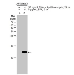 Western blot - Anti-IL-2 antibody (AB227101)