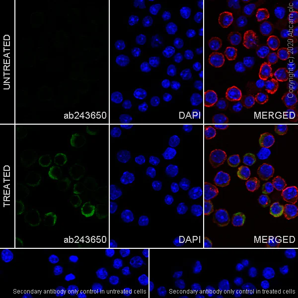 Immunocytochemistry/ Immunofluorescence - Anti-IL-2 antibody [EPR16615-341] (AB243650)