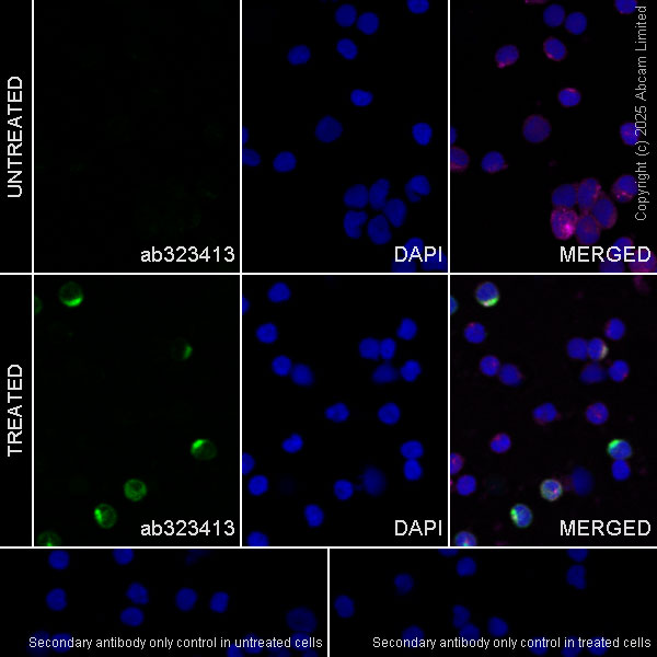 Immunocytochemistry/ Immunofluorescence - Anti-IL-2 antibody [EPR28940-593] (AB323413), expandable thumbnail