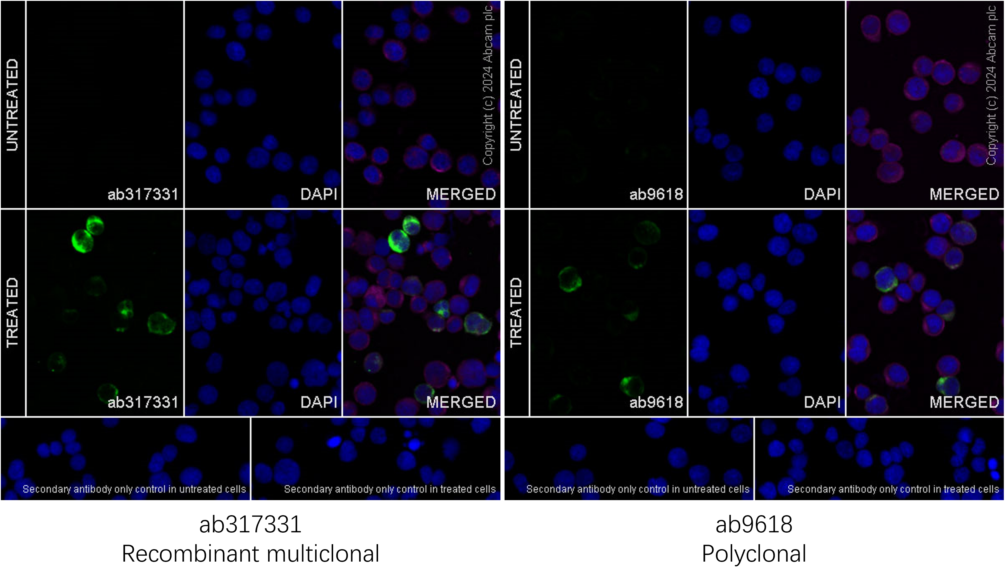 Immunocytochemistry/ Immunofluorescence - Anti-IL-2 antibody [RM1124] (AB317331)