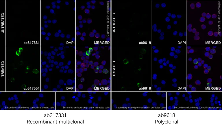 Immunocytochemistry/ Immunofluorescence - Anti-IL-2 antibody [RM1124] - BSA and Azide free (AB317332)