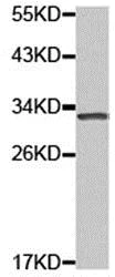 Western blot - Anti-IL-2 Receptor alpha antibody (AB176438)
