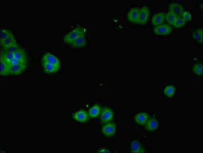 Immunocytochemistry/ Immunofluorescence - Anti-IL-2 Receptor alpha antibody (AB235906)