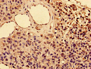 Immunohistochemistry (Formalin/PFA-fixed paraffin-embedded sections) - Anti-IL-2 Receptor alpha antibody (AB235906)
