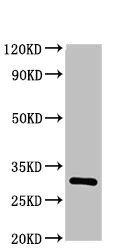 Western blot - Anti-IL-2 Receptor alpha antibody (AB235906)