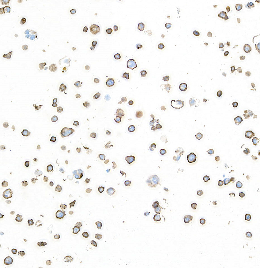 Immunocytochemistry - Anti-IL-2 Receptor alpha antibody [BLR157J] - BSA free (AB314083), expandable thumbnail