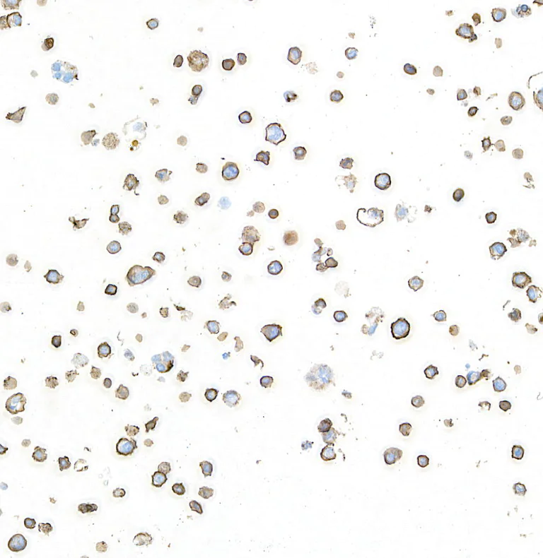 Immunocytochemistry - Anti-IL-2 Receptor alpha antibody [BLR157J] - BSA free (AB314083)