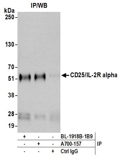 Immunoprecipitation - Anti-IL-2 Receptor alpha antibody [BLR157J] - BSA free (AB314083), expandable thumbnail