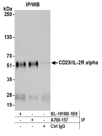 Immunoprecipitation - Anti-IL-2 Receptor alpha antibody [BLR157J] - BSA free (AB314083)