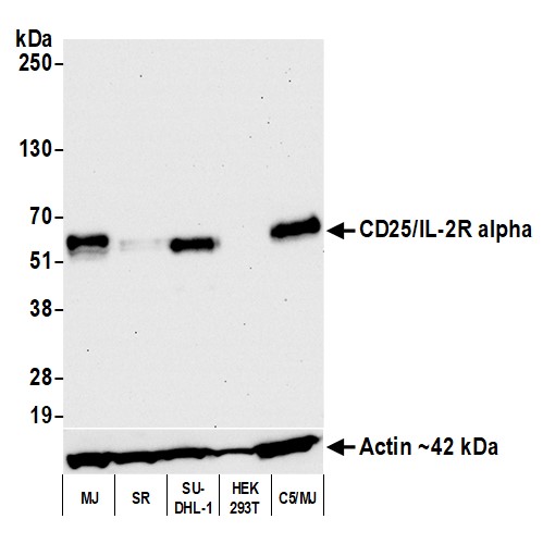 Western blot - Anti-IL-2 Receptor alpha antibody [BLR157J] - BSA free (AB314083), expandable thumbnail