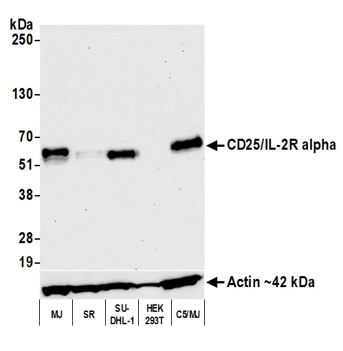 Western blot - Anti-IL-2 Receptor alpha antibody [BLR157J] - BSA free (AB314083)
