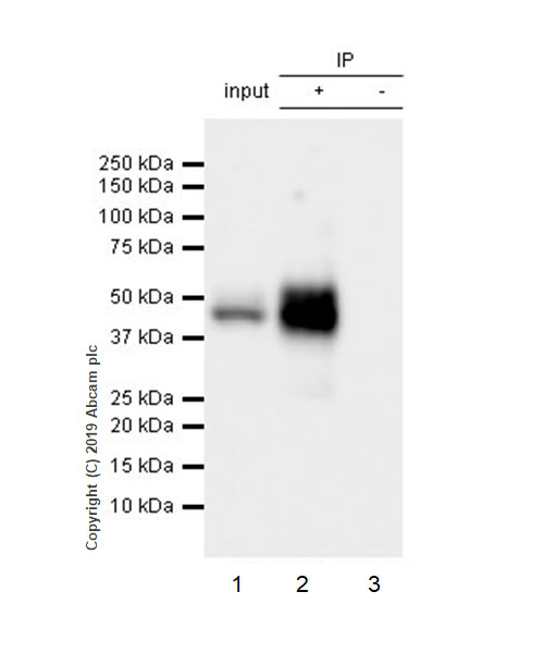 Immunoprecipitation - Anti-IL-2 Receptor alpha antibody [EPR22588-118] (AB255732)