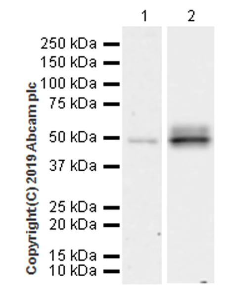 Western blot - Anti-IL-2 Receptor alpha antibody [EPR22588-118] (AB255732)