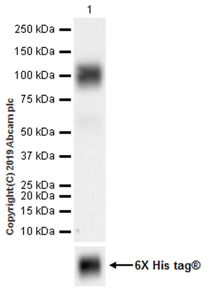 Western blot - Anti-IL-2 Receptor alpha antibody [EPR22588-118] (AB255732)