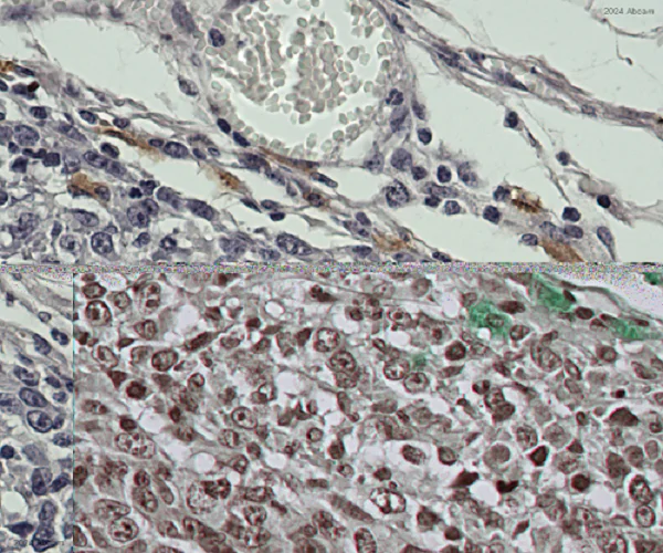 Immunohistochemistry (Formalin/PFA-fixed paraffin-embedded sections) - Anti-IL-2 Receptor alpha antibody [EPR22588-18] (AB227834)