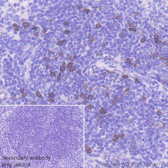 Immunohistochemistry (Formalin/PFA-fixed paraffin-embedded sections) - Anti-IL-2 Receptor alpha antibody [EPR22588-18] - BSA and Azide free (AB255858), expandable thumbnail