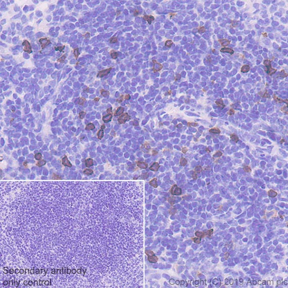 Immunohistochemistry (Formalin/PFA-fixed paraffin-embedded sections) - Anti-IL-2 Receptor alpha antibody [EPR22588-18] - BSA and Azide free (AB255858)