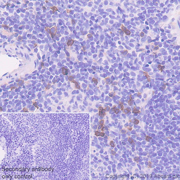 Immunohistochemistry (Formalin/PFA-fixed paraffin-embedded sections) - Anti-IL-2 Receptor alpha antibody [EPR22588-18] - BSA and Azide free (AB255858), expandable thumbnail