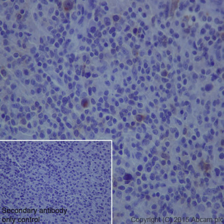 Immunohistochemistry (Formalin/PFA-fixed paraffin-embedded sections) - Anti-IL-2 Receptor alpha antibody [EPR6452] (AB128955), expandable thumbnail