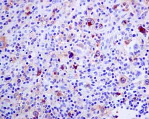 Immunohistochemistry (Formalin/PFA-fixed paraffin-embedded sections) - Anti-IL-2 Receptor alpha antibody [EPR6452] (AB128955), expandable thumbnail