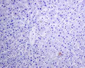 Immunohistochemistry (Formalin/PFA-fixed paraffin-embedded sections) - Anti-IL-2 Receptor alpha antibody [EPR6452] (AB128955)
