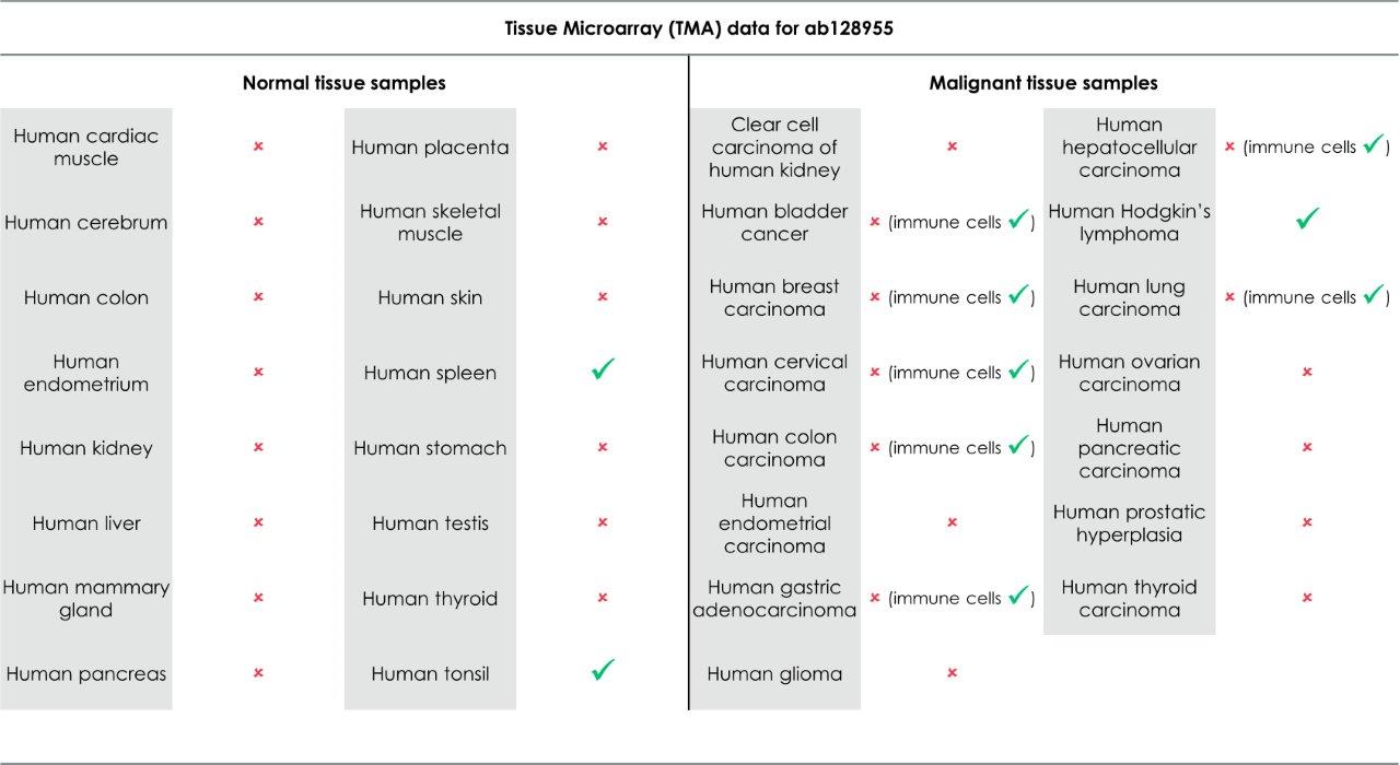 Immunohistochemistry (Formalin/PFA-fixed paraffin-embedded sections) - Anti-IL-2 Receptor alpha antibody [EPR6452] (ab128955), expandable thumbnail