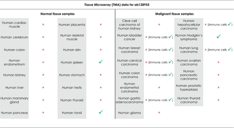 Immunohistochemistry (Formalin/PFA-fixed paraffin-embedded sections) - Anti-IL-2 Receptor alpha antibody [EPR6452] (AB128955)