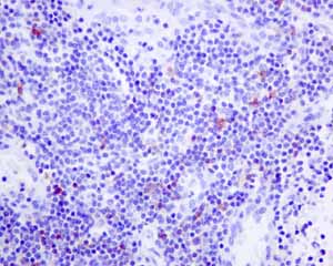 Immunohistochemistry (Formalin/PFA-fixed paraffin-embedded sections) - Anti-IL-2 Receptor alpha antibody [EPR6452] (ab128955), expandable thumbnail