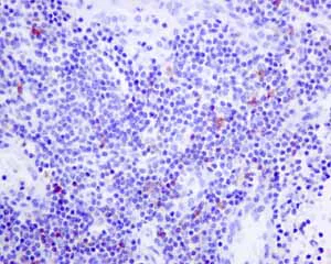 Immunohistochemistry (Formalin/PFA-fixed paraffin-embedded sections) - Anti-IL-2 Receptor alpha antibody [EPR6452] (AB128955)