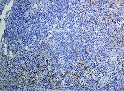 Immunohistochemistry (Formalin/PFA-fixed paraffin-embedded sections) - Anti-IL-2 Receptor alpha antibody [EPR6452] (AB128955), expandable thumbnail