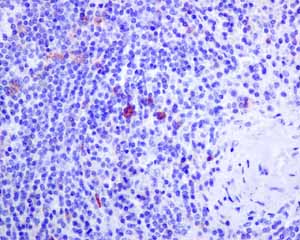 Immunohistochemistry (Formalin/PFA-fixed paraffin-embedded sections) - Anti-IL-2 Receptor alpha antibody [EPR6452] (ab128955), expandable thumbnail